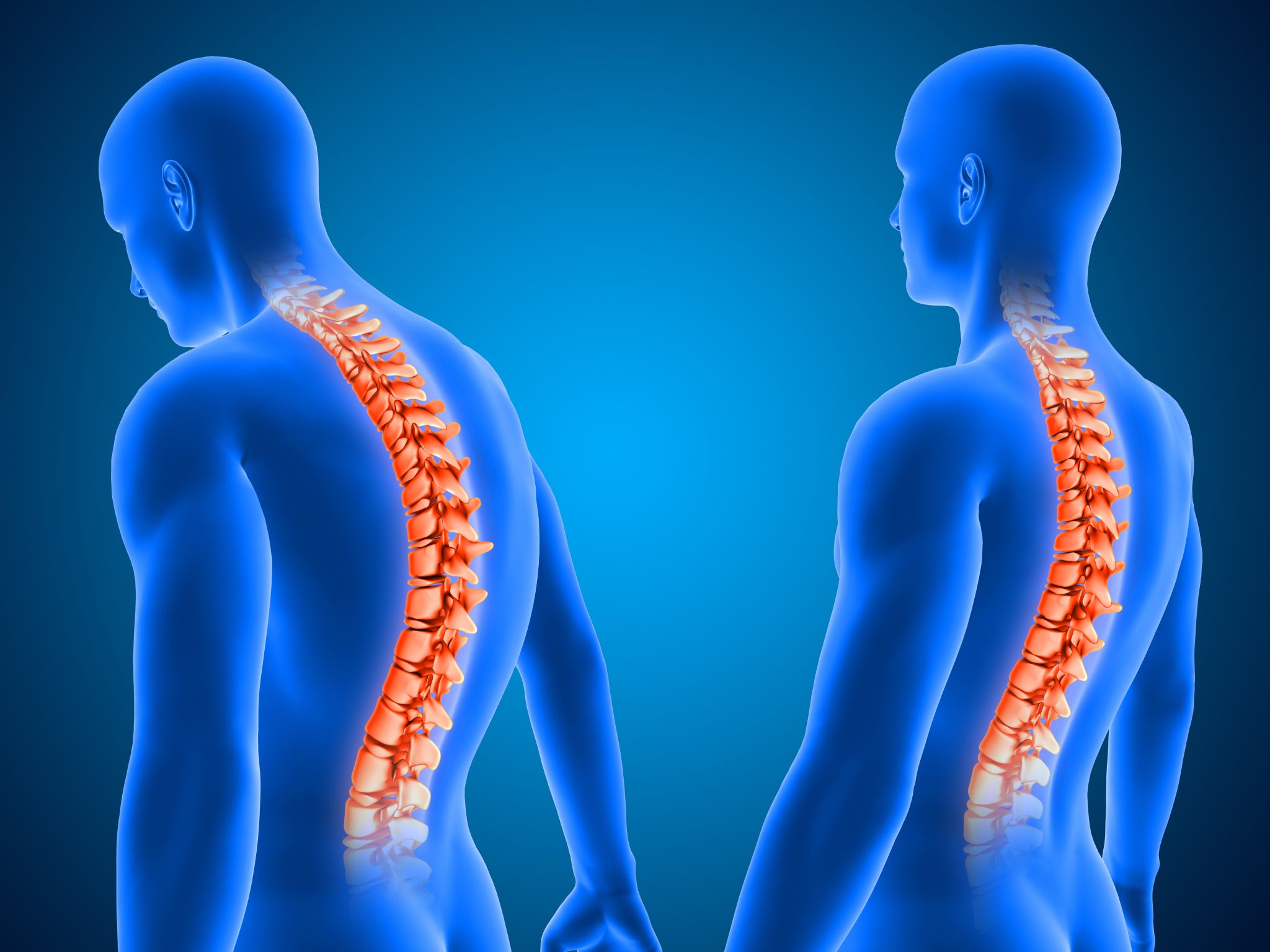 cervical-spine-surgery-in-pune